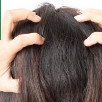 Demodex and Itchy Scalp